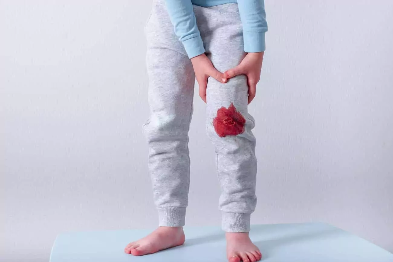 How To Get Blood Out of Clothes blood stains on pants
