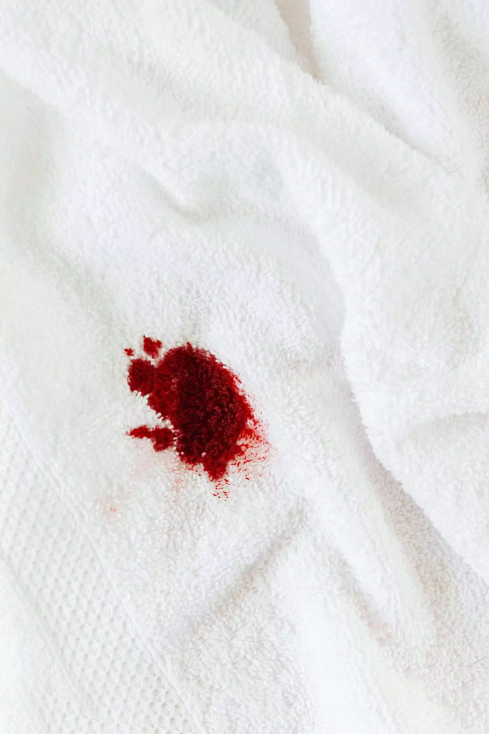 How To Get Blood Out of Clothes red stain on towel